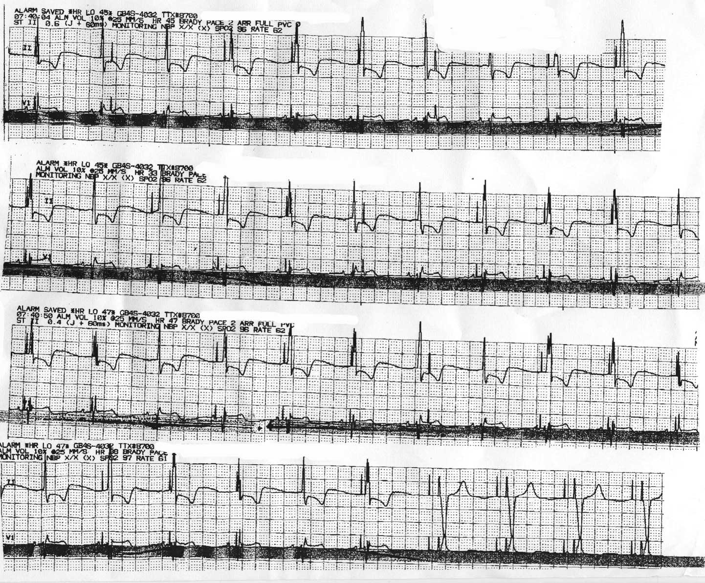 Telemetry Tech position VS. Nursing.